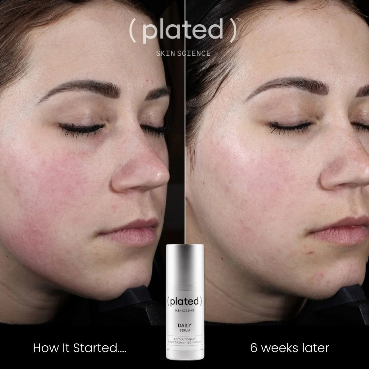 Plated Daily Serum